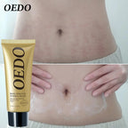 Creme Para Remoção de Estrias - ®OEDO BEAUTY