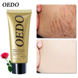Creme Para Remoção de Estrias - ®OEDO BEAUTY