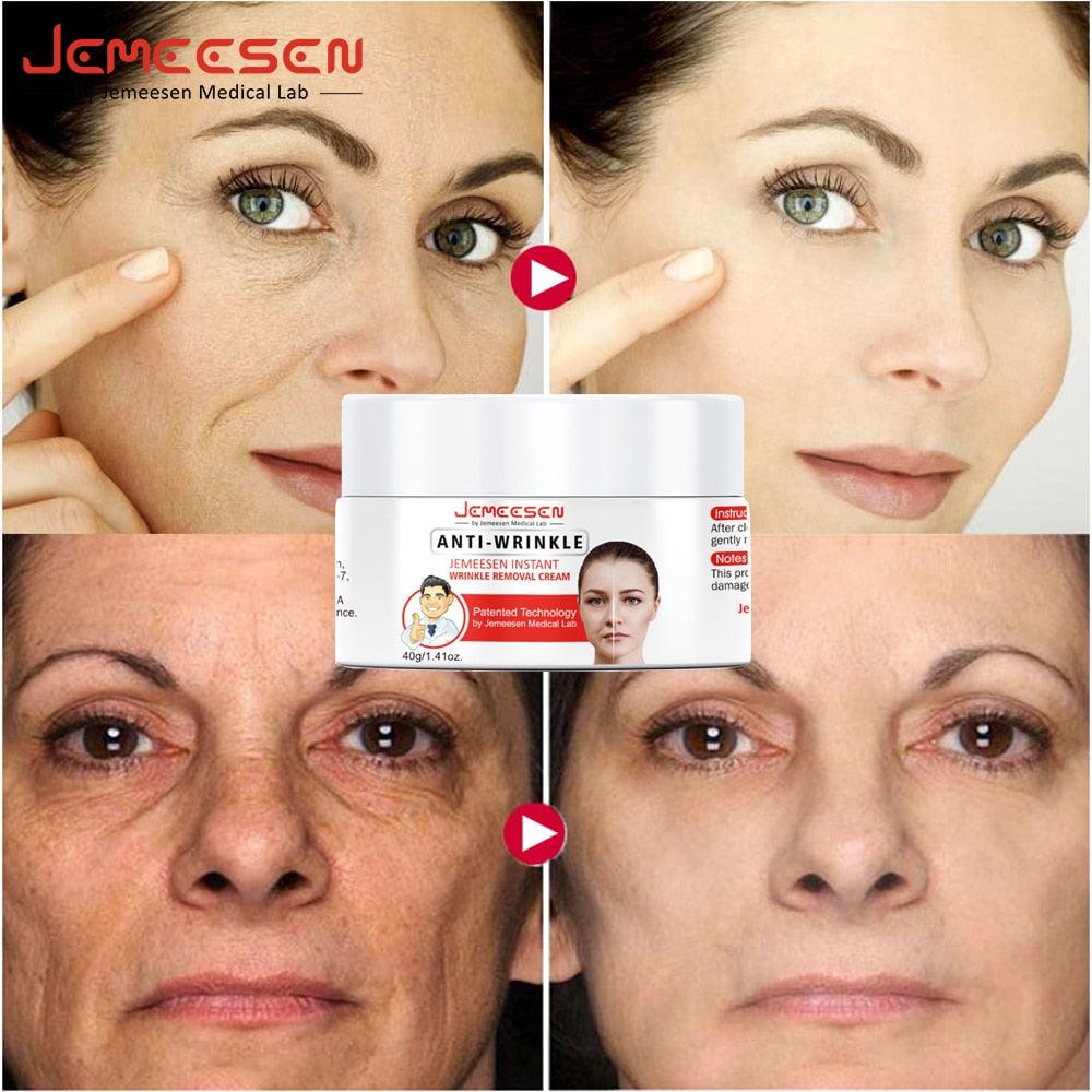 Creme Removedor de Rugas e Linhas de Expressão - ®JEMEESEN BEAUTY