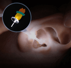 Limpador de Orelha com LED ®BabyCleaner (Lançamento)