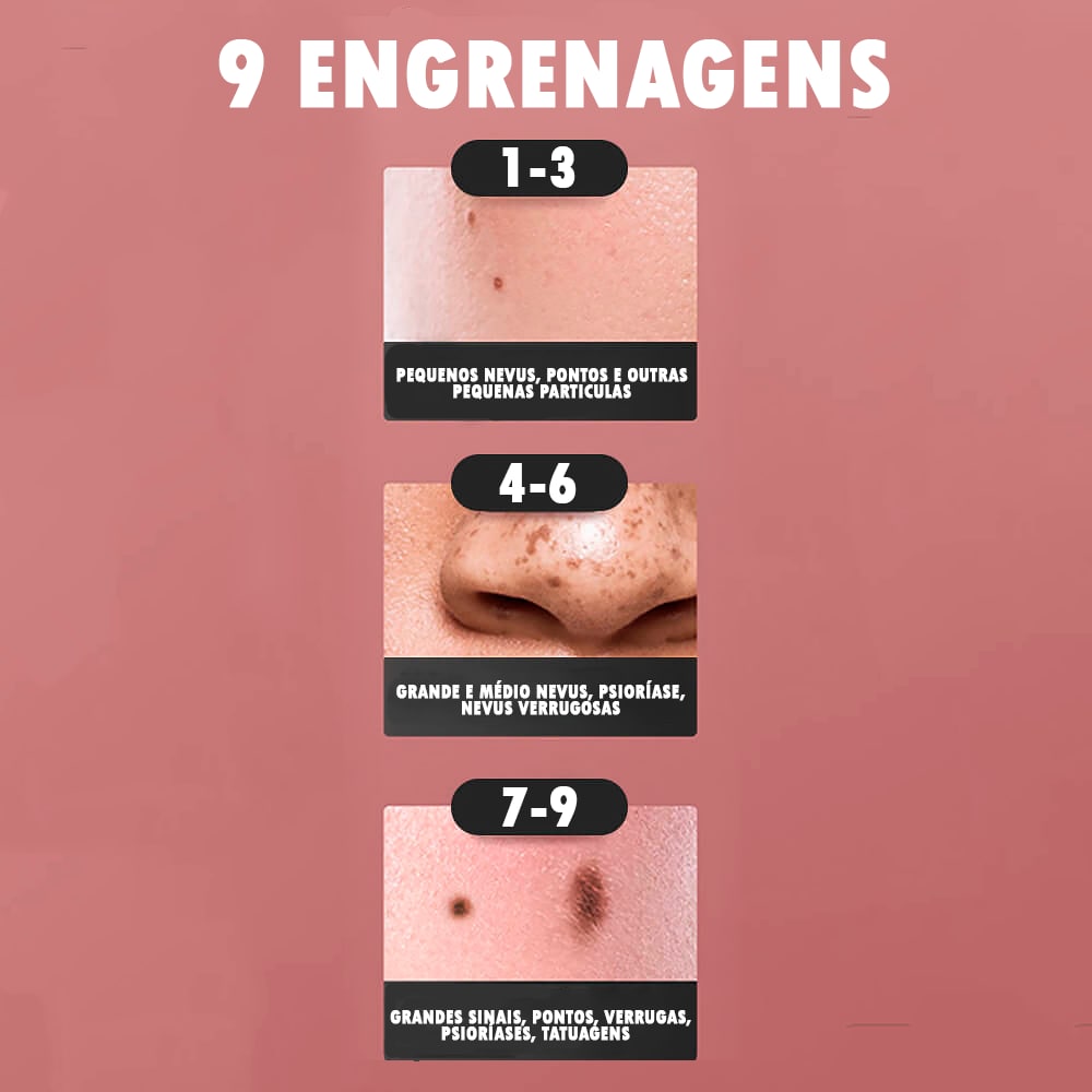 Caneta Laser Plasma 9 em 1 Removedora de manchas, verrugas, sardas e tatuagem ®PenPlasma