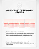 Removedor de Cravos Lanbena + 60 Adesivos Aplicadores (Brinde) 2 em 1