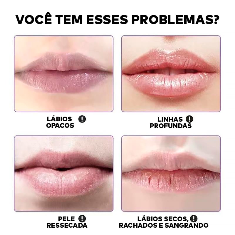 Brilho Hidratante Labial com Própolis e Geleia Real ®HidraMel (Máscara Antirrugas Labial)
