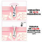 Caneta Massageadora Iônica Anti Rugas e Olheiras ®YoungBeutry (PELE 100% MAIS JOVEM)