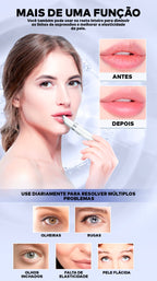 Caneta Massageadora Iônica Anti Rugas e Olheiras ®YoungBeutry (PELE 100% MAIS JOVEM)