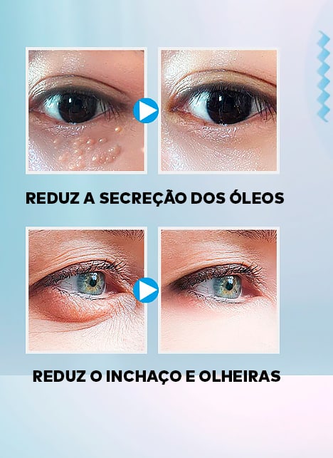 Caneta Massageadora Iônica Anti Rugas e Olheiras ®YoungBeutry (PELE 100% MAIS JOVEM)