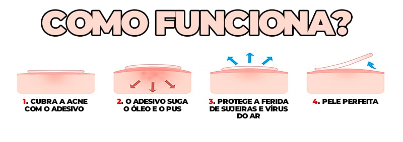 Adesivo Secador e Clareador de Espinha 36/144 Peças - SKIN PATCH®