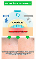 Adesivo Secador e Clareador de Espinha 36/144 Peças - SKIN PATCH®