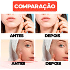 Adesivo Secador e Clareador de Espinha 36/144 Peças - SKIN PATCH®