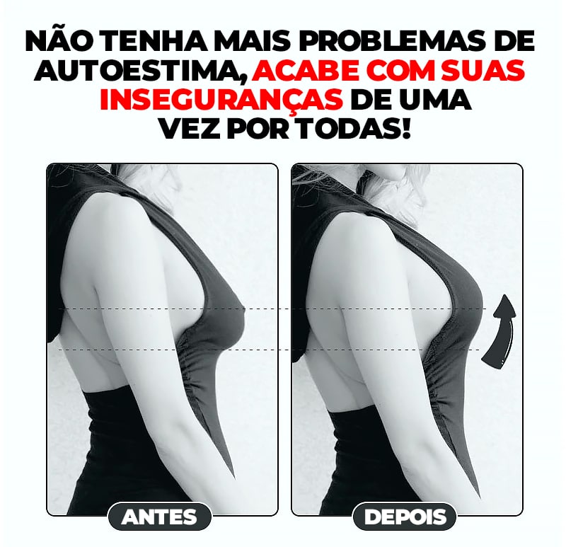 Fita Adesiva Levanta Seio 5 METROS - PushUp Invisível®