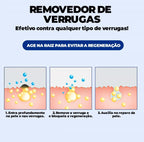 Removedor de Verrugas Olho de Peixe ®ClearCream