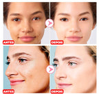 Creme Removedor de Manchas -®PinkBeauty