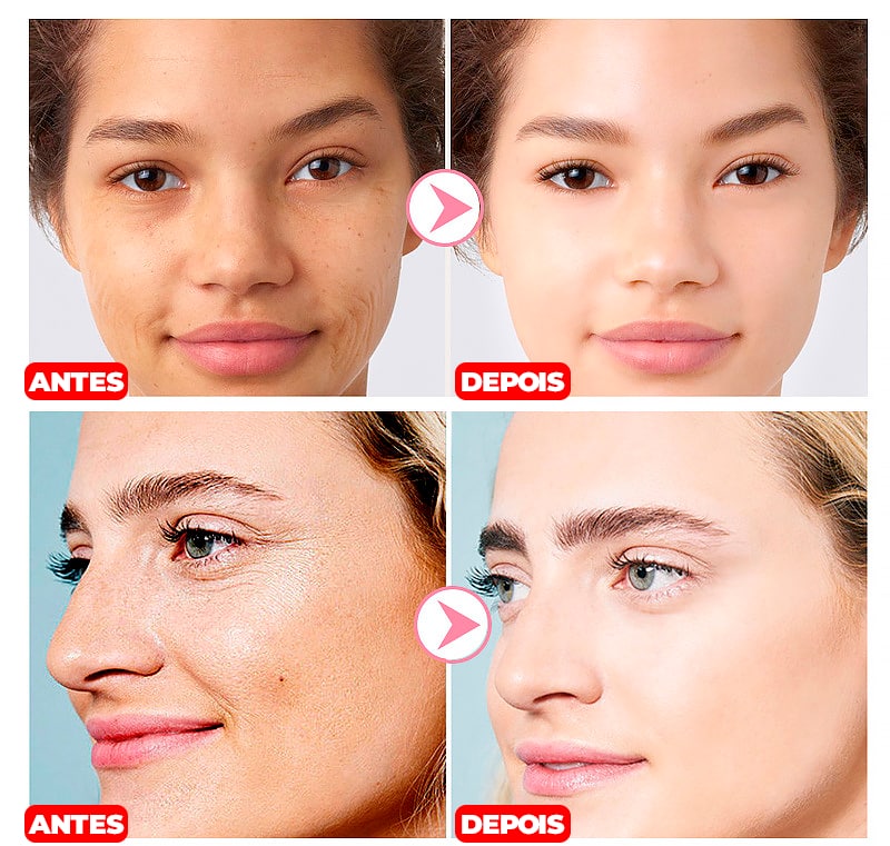 Creme Removedor de Manchas -®PinkBeauty