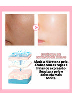 Creme Removedor de Manchas -®PinkBeauty