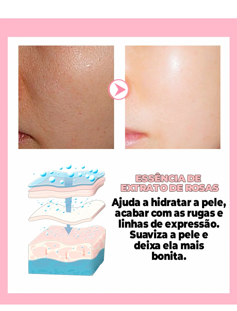 Creme Removedor de Manchas -®PinkBeauty