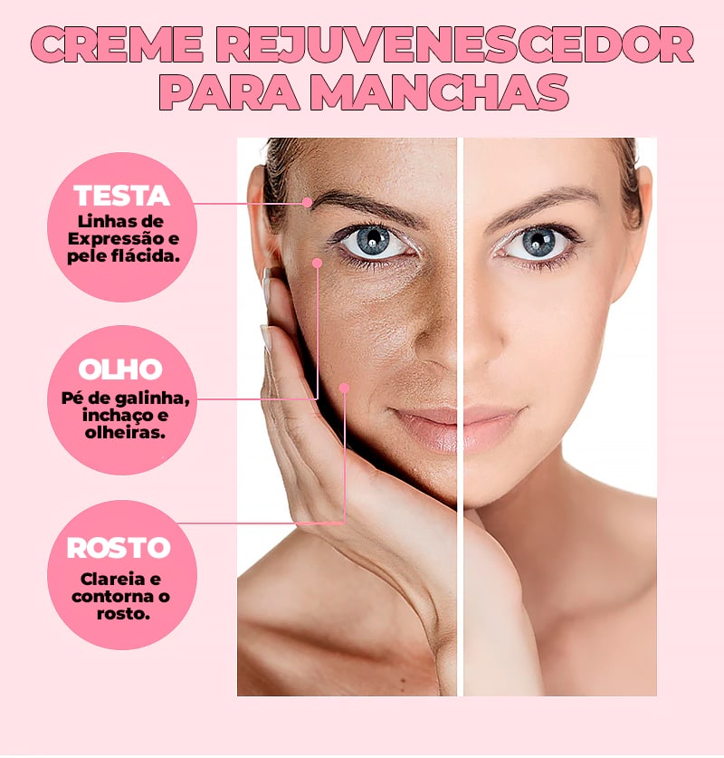 Creme Removedor de Manchas -®PinkBeauty