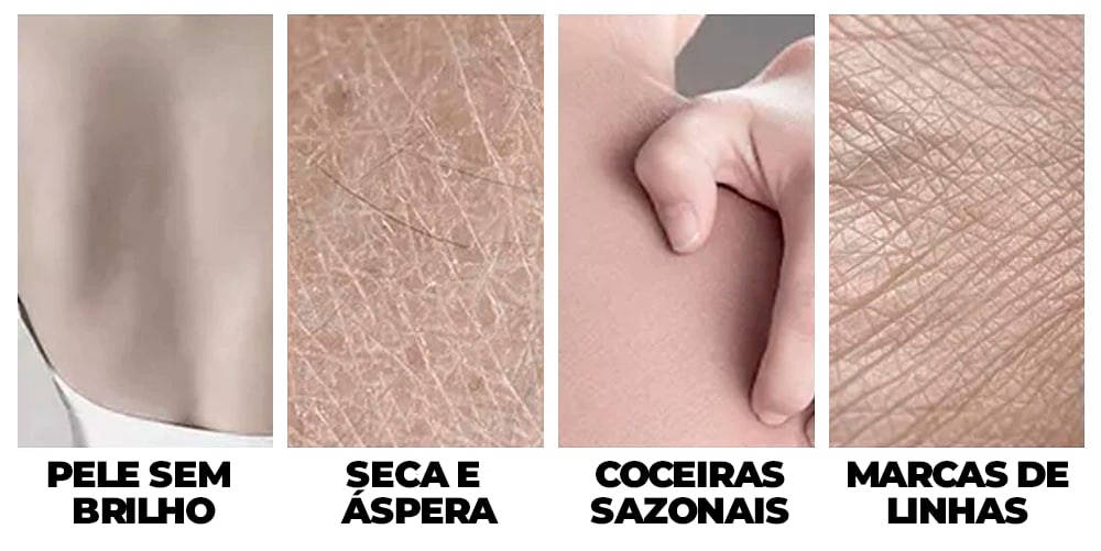 Creme Clareador de Axilas, Virilha, Pescoço e Cotovelo - Retinol®