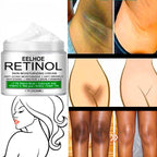 Creme Clareador de Axilas, Virilha, Pescoço e Cotovelo - Retinol®