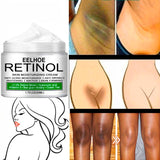 Creme Clareador de Axilas, Virilha, Pescoço e Cotovelo - Retinol®