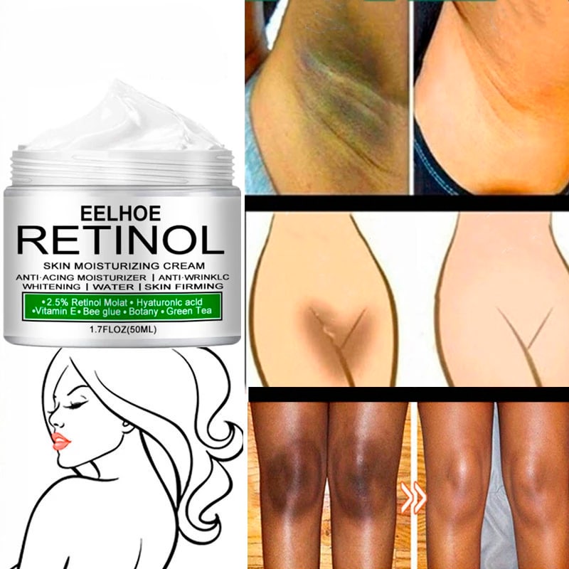 Creme Clareador de Axilas, Virilha, Pescoço e Cotovelo - Retinol®