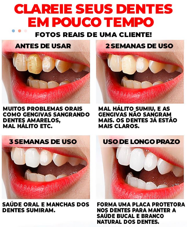 Super Clareador Dental e Removedor de Manchas -®RtopR