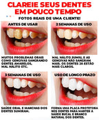 Super Clareador Dental e Removedor de Manchas -®RtopR