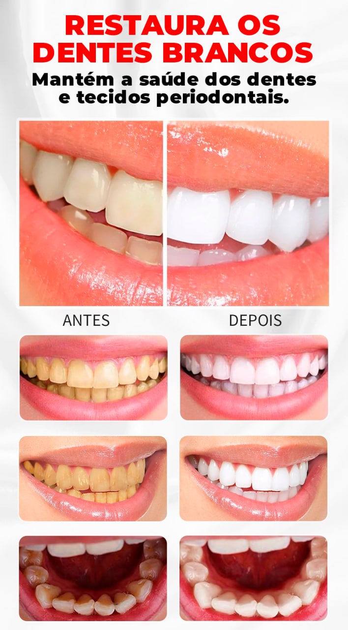 Super Clareador Dental e Removedor de Manchas -®RtopR
