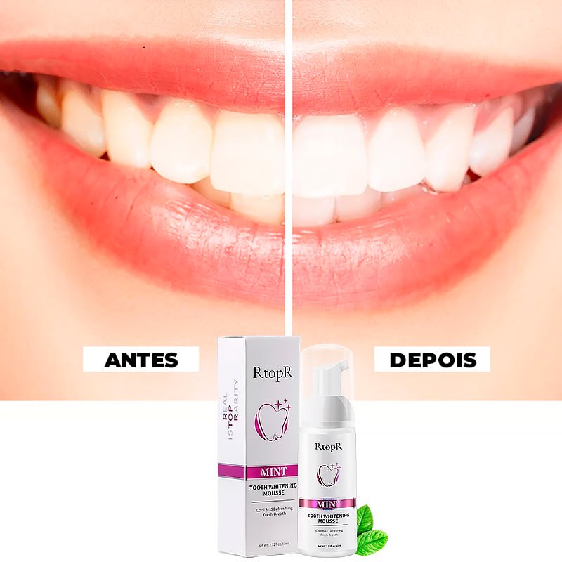 Super Clareador Dental e Removedor de Manchas -®RtopR