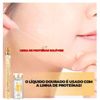 Kit Fios de Colágeno e Seda Removedores de Linhas de Expressão 40 PEÇAS -  ®LiftGold