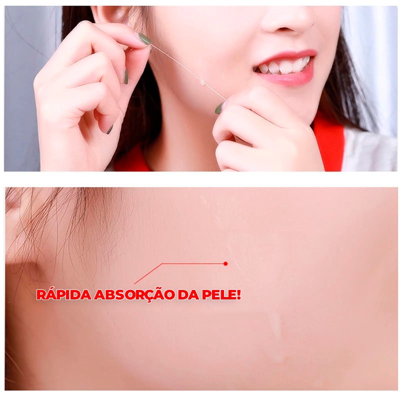 Kit Fios de Colágeno e Seda Removedores de Linhas de Expressão 40 PEÇAS -  ®LiftGold