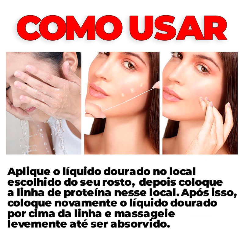 Kit Fios de Colágeno e Seda Removedores de Linhas de Expressão 40 PEÇAS -  ®LiftGold