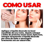 Kit Fios de Colágeno e Seda Removedores de Linhas de Expressão 40 PEÇAS -  ®LiftGold