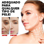 Kit Fios de Colágeno e Seda Removedores de Linhas de Expressão 40 PEÇAS -  ®LiftGold