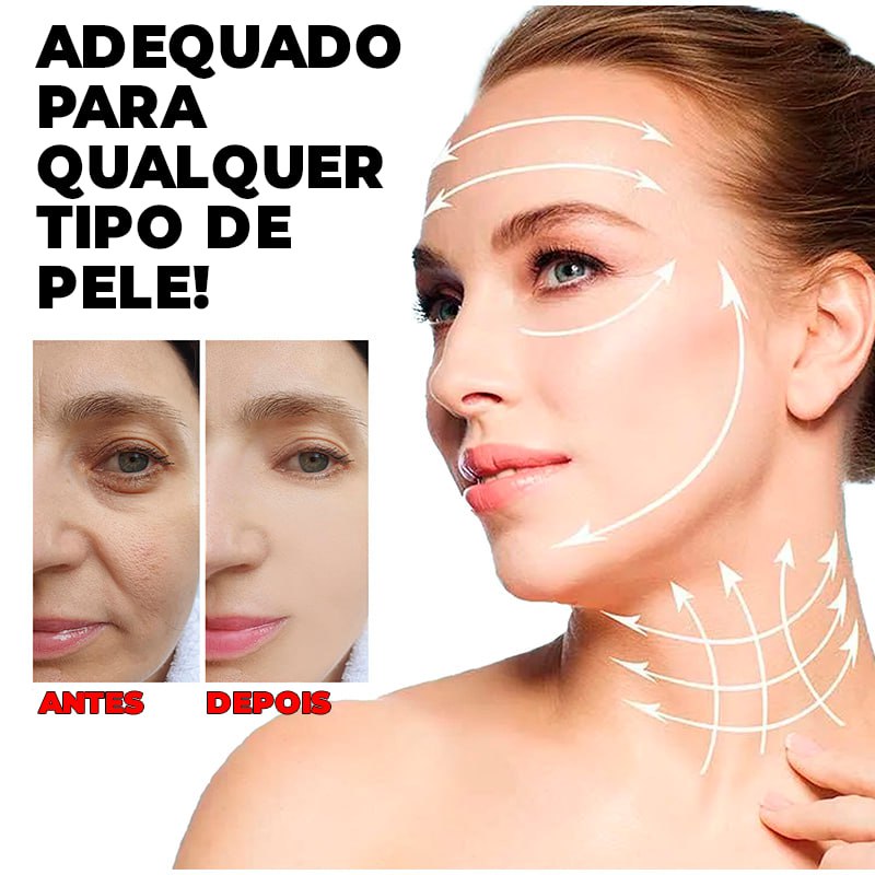 Kit Fios de Colágeno e Seda Removedores de Linhas de Expressão 40 PEÇAS -  ®LiftGold